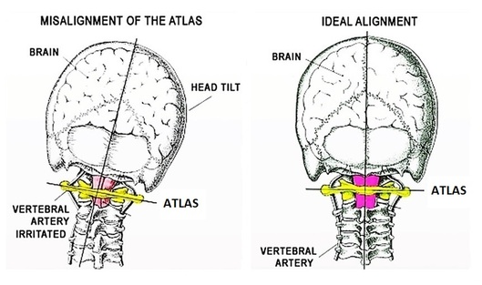 Atlas Orthogonal Chiropractor Kissimmee Atlas Orthogonal